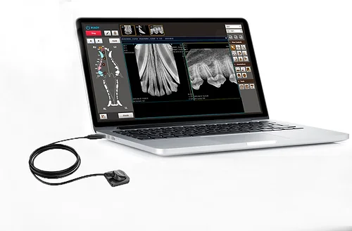 DR Dental EzSensor